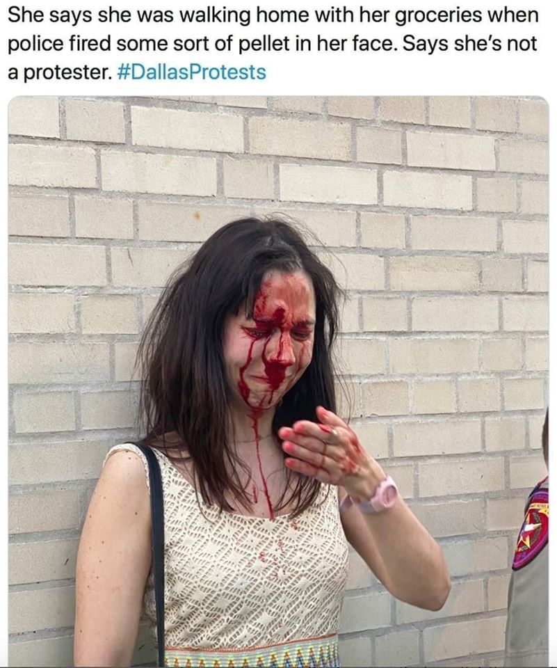 This meme features a photo of a woman with a bloodied face, looking shocked and upset. The text above the image reads: "She says she was walking home with her groceries when police fired some sort of pellet in her face. Says she's not a protester." The meme is likely poking fun at the idea that the woman is trying to downplay her involvement in a protest, despite the obvious evidence of her injuries.