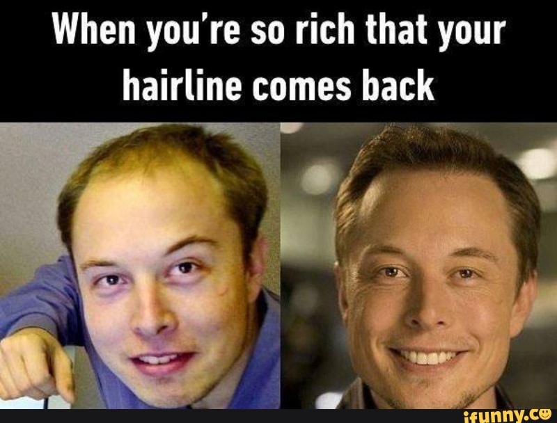 This meme is a humorous comparison between two images of Elon Musk, the billionaire entrepreneur. The top text reads "When you're so rich that your hairline comes back" and the bottom text is not visible in the provided text, but it's likely a humorous comment about his hairline. The meme pokes fun at the idea that wealth can even reverse the effects of aging, specifically a receding hairline.