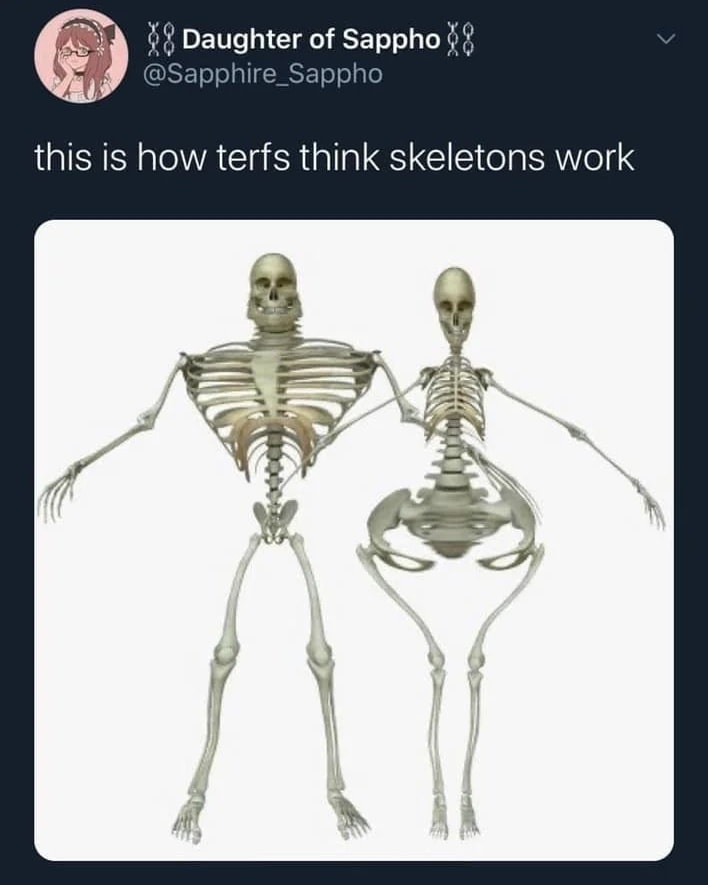 This meme is a humorous comparison between the physical appearance of fans of the TV show "Star Trek" (Trekies) and fans of the TV show "Star Trek: The Next Generation" (TNGies). The meme states "this is how trekkies and tngies are the same" and shows a split image of a skeleton with one side having a muscular build and the other side having a more slender build. The text "this is how trekkies and tngies are the same" appears above the image.